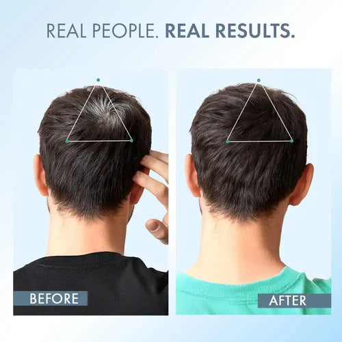 Anti-Grey Hair Serum
