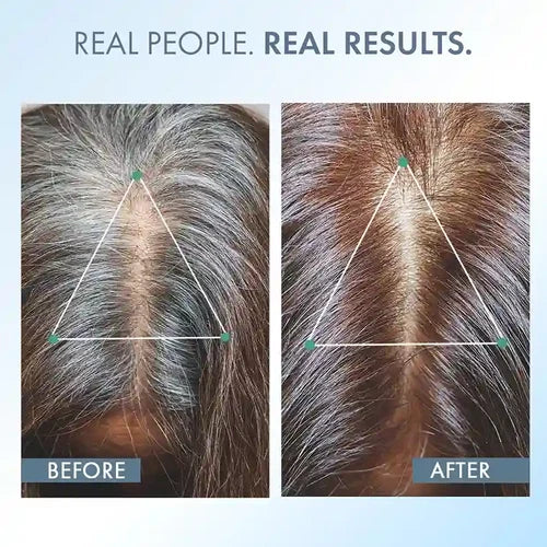 Anti-Grey Hair Serum
